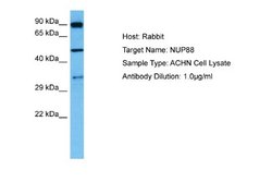 NUP88 Rabbit anti-Human, Polyclonal, Novus Biologicals 0.1ml; Unconjugated:Antibodies,